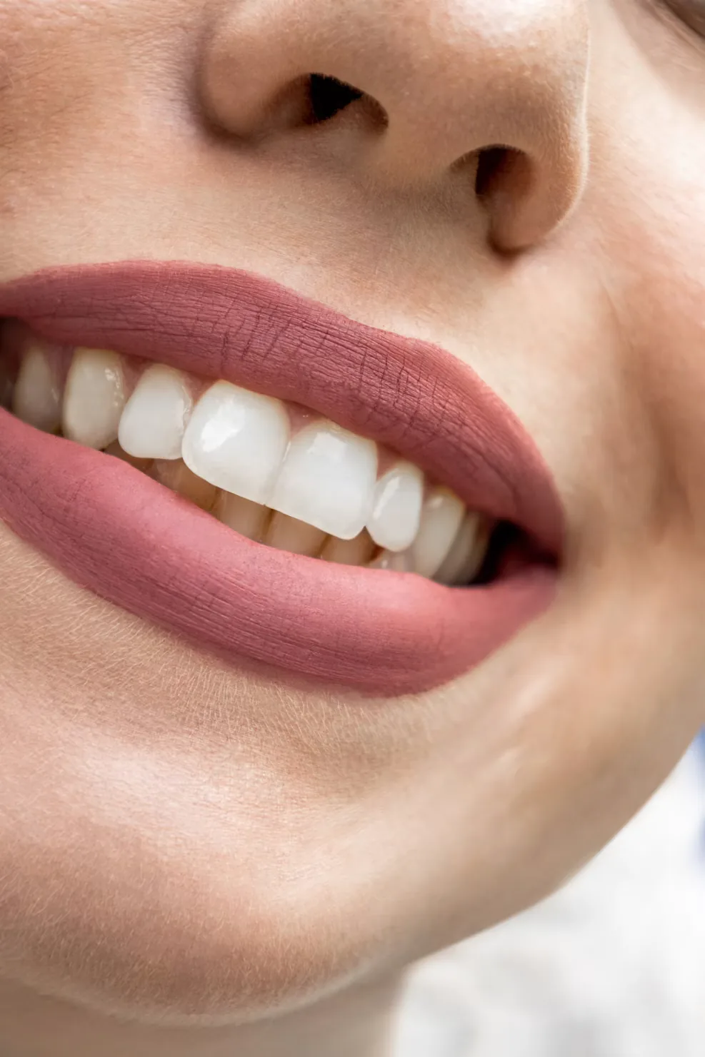 Sorriso naturale e armonioso — approccio alla medicina estetica del Centro Medico Minetti Milano