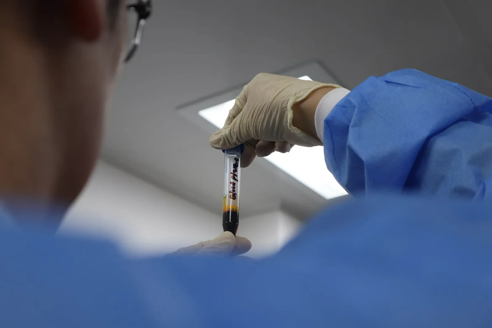 Prelievo e analisi del sangue — ematologia al Centro Medico Minetti Milano