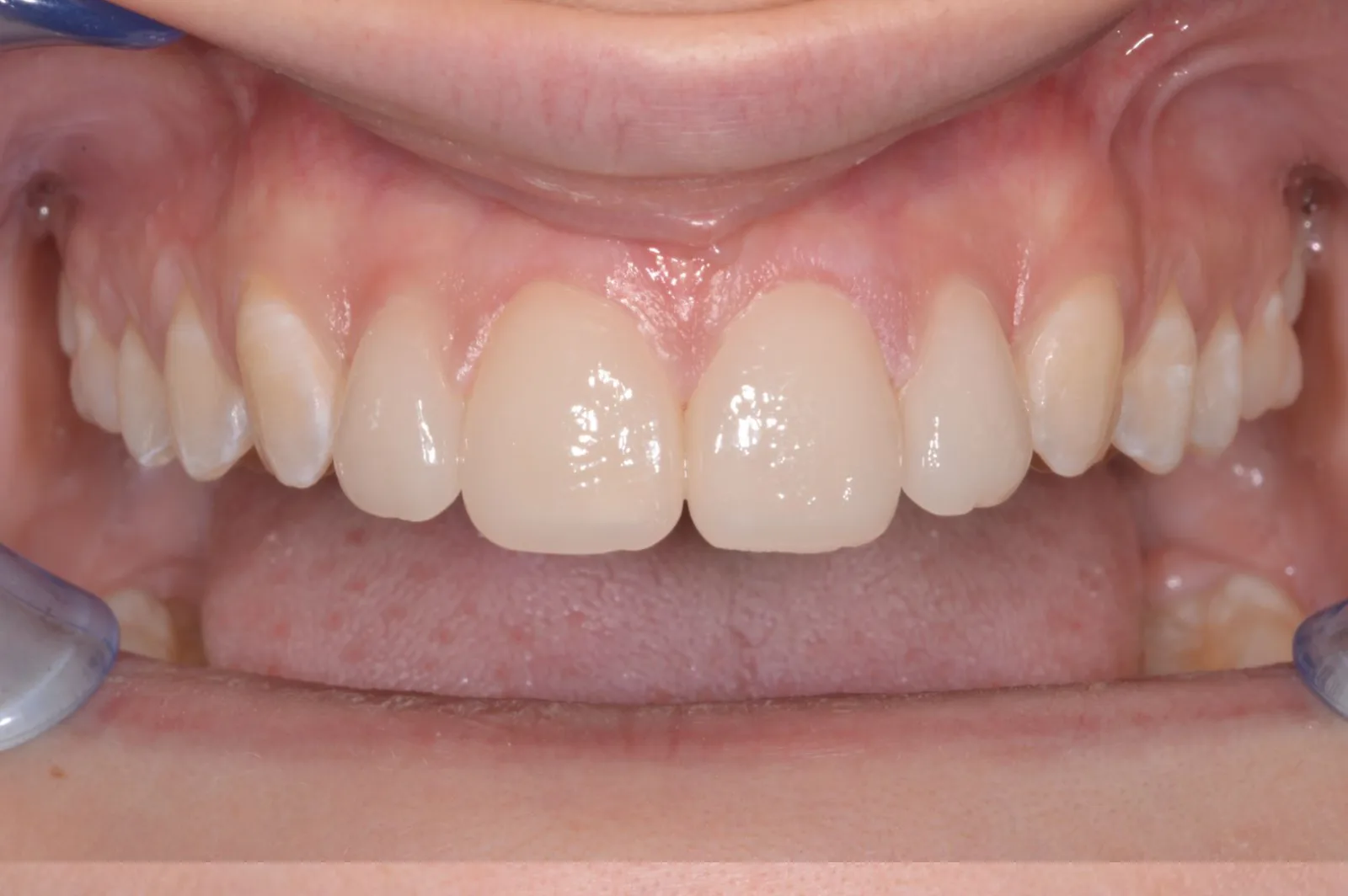 Dopo — estetica dentale