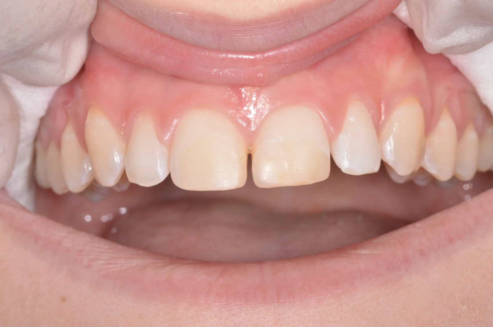 Prima — estetica dentale