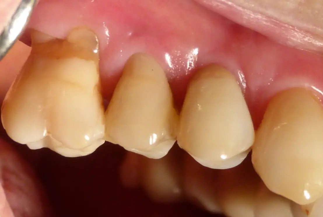 Dopo — implantologia dentale