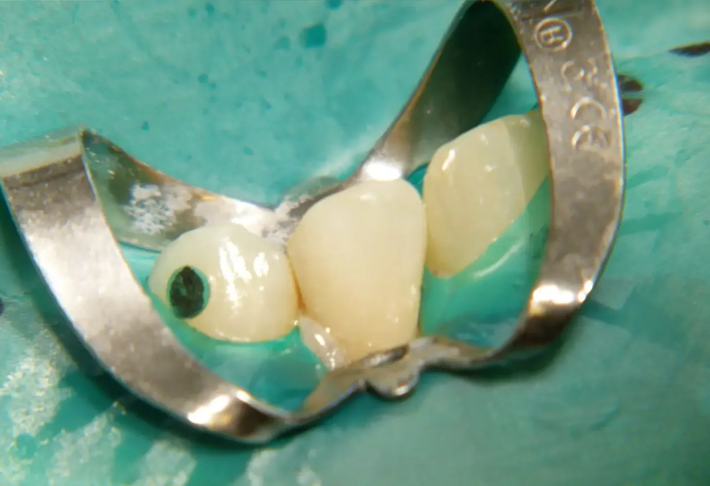 Dopo — odontoiatria conservativa