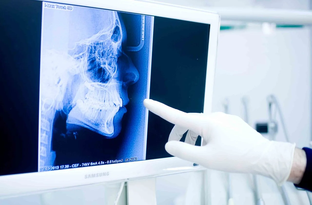 Gnatologia — dispositivo occlusale e analisi della mandibola