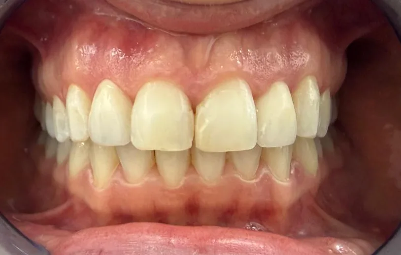 Igiene e profilassi dentale al Centro Medico Minetti Milano